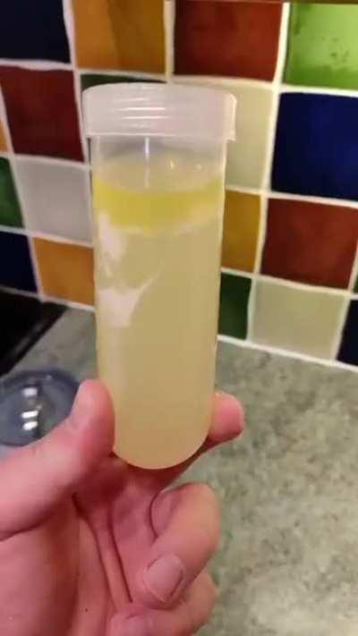 Thanks, I hate chicken soup.