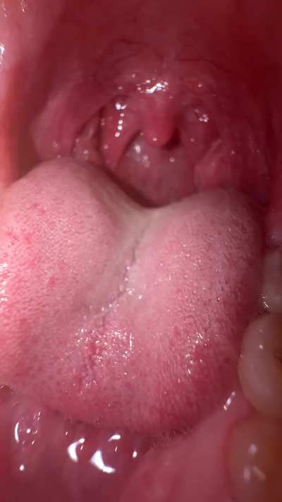 ready to melt inside my stomach? oc