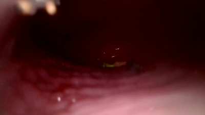 My cervix is so much bigger than you guys!