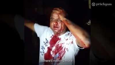 Bengal Burns © Prachyam