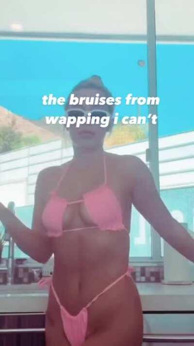 Bruises