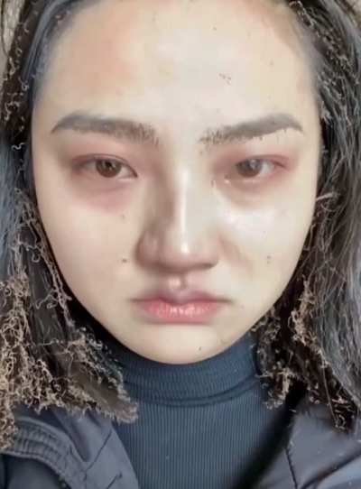 Crowd freaks when someone bats molten metal at them and turns out it doesn’t feel as cool as it looks..