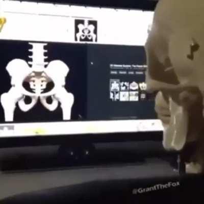 minecraft skeleton