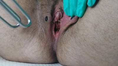 not even started a session and my peehole looks like this 🫢