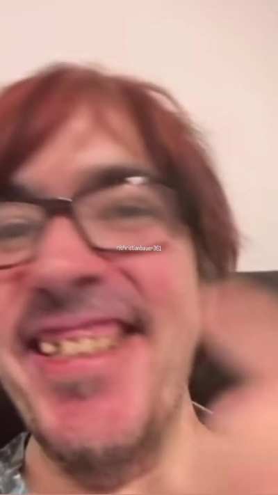 Christian zeigt stolz seine neue Zahnlücke