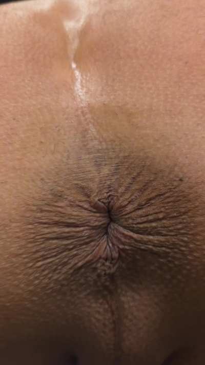 I need a rectal examination..