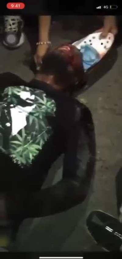 one of the many casualties or injure of the conflict between the police and the Colombian protestors.