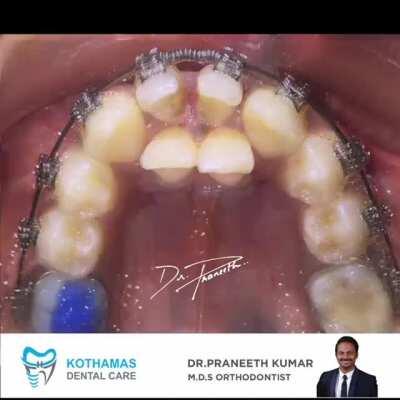 I think you'll love this