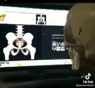 I got a 207th bone!!