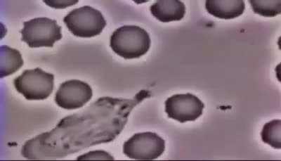 Bacteria vs globulo branco ao som de link park 😎👍 ( luta mto foda)