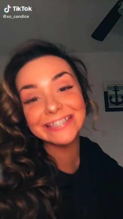 Cute With Braces Wants 🍫