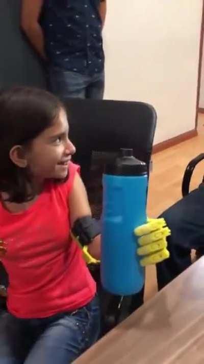 The man that gives the high five is one of my university teachers. For years he’s been working towards producing low cost, affordable prosthesis for kids, a couple of weeks ago this girl got the first one.