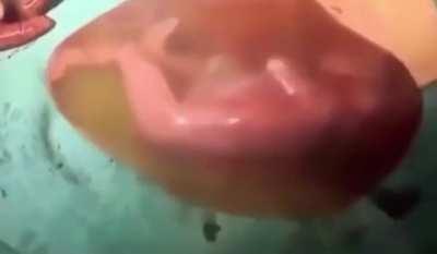 How is this possible with the umbilical cord?