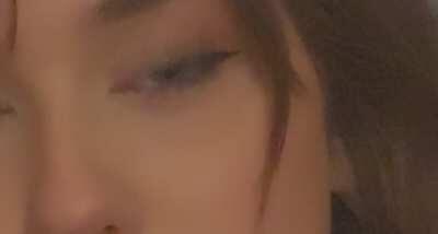 Pupils at 1 g~ about 1 hour in