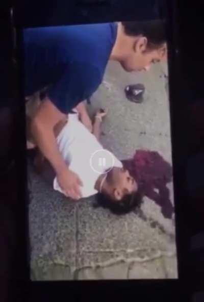 Likea 🥜 how his head crackk 🔂🤷🏽‍♂️