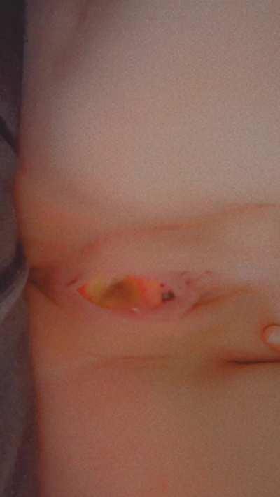 An apple a day keeps the doctor away right? 🤭