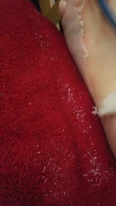 Soaked feet, sliced skin