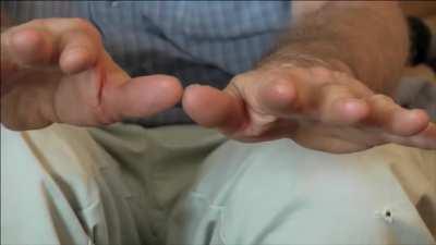 Weed+ Parkinson’s incredible