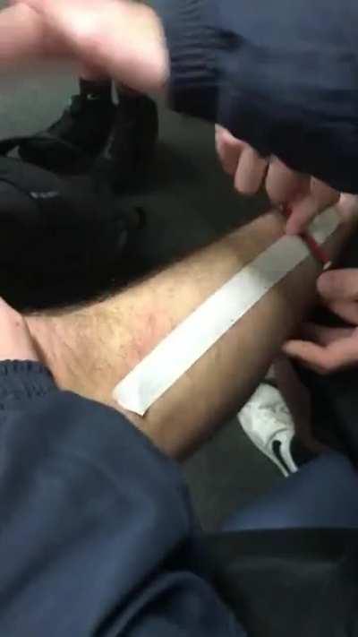waxxed someones leg with tape