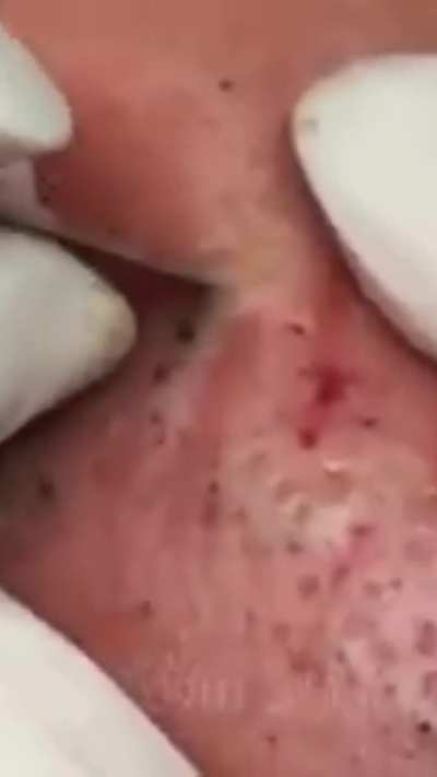 Any comment on this???