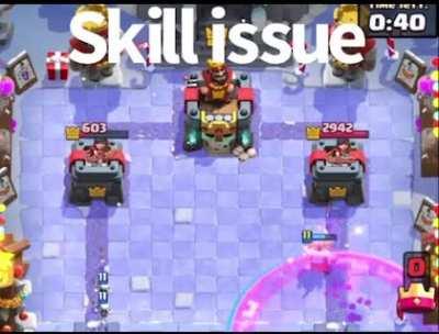 Skill issue
