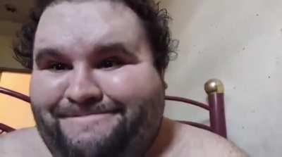 I don’t know what’s more wtf worthy, the guy or the black mold