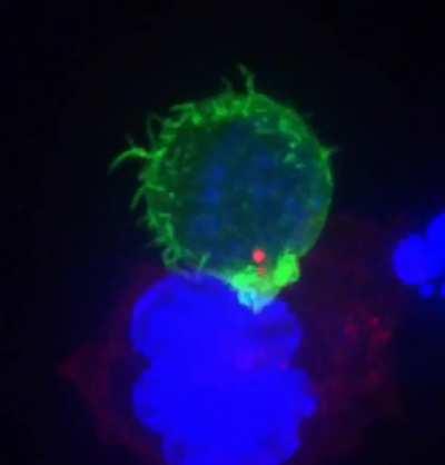 Killer T cell in green in immune system attacking the Cancerous red and blue cell.