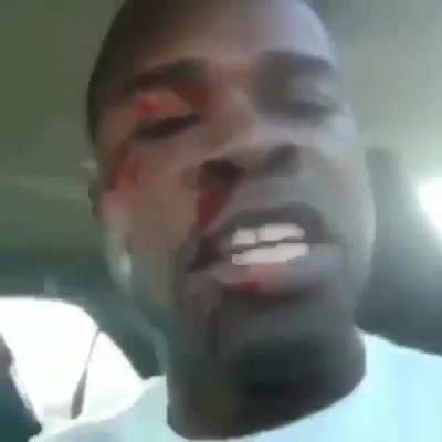 She he have hit her back?