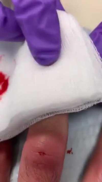 Thanks, I hate recorded nail removing