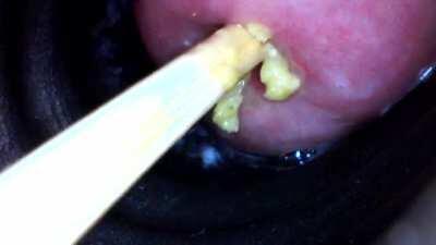 the sushi bar upgrade is worth it - getting off on real wasabi (audio)