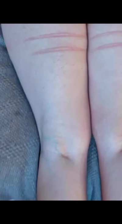 Aftermath: 5 lashes with the rubber whip