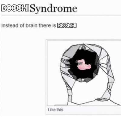 Bocchi syndrome