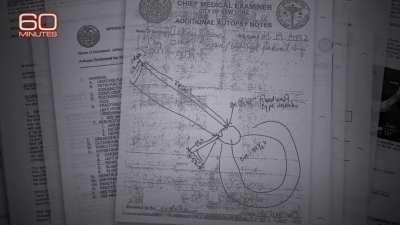 Jeffrey Epstein autopsy explained