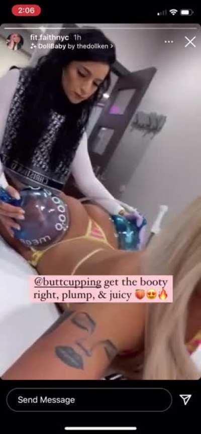 Butt cupping
