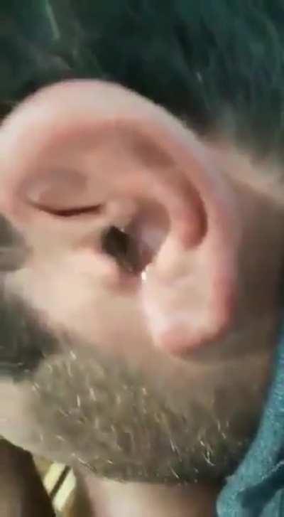 What’s in your ear?