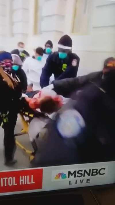 A woman at the Capitol possibly dead or dying