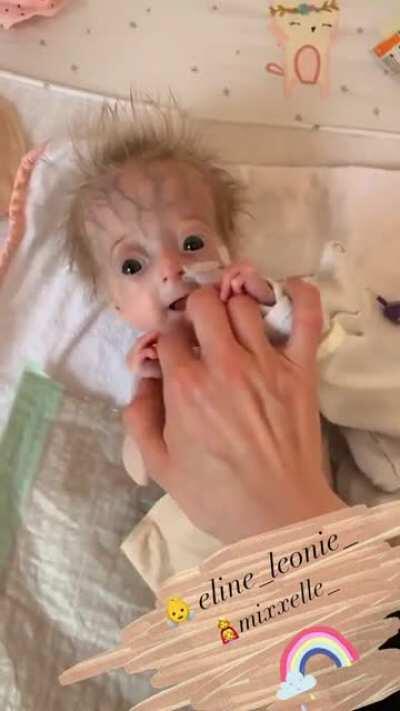 olum bebek çok erken doğmuş