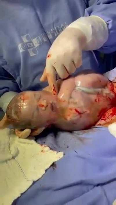 woke me up from my nap you prick