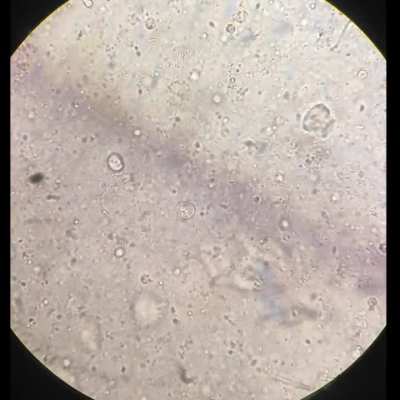 Sperm cells dekh lo guys