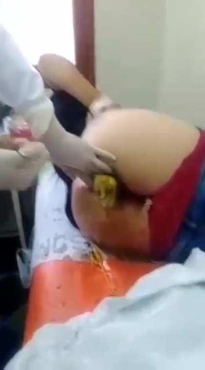 Don’t stick vegetables up your ass