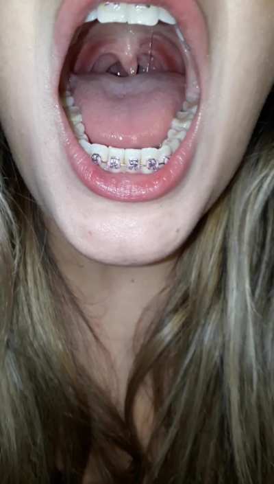 Deep into my throat can you see my uvula pulsing?