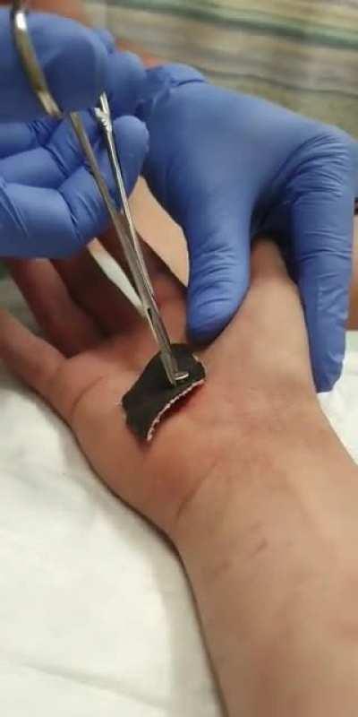 My drill slipped....