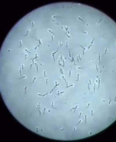 os meus espermatozoides percebendo q eles estao dentro da filha da esposa do meu padrasto: