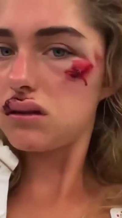 Going to bomb a massive hill.