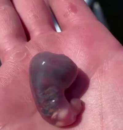 Thanks, I hate whatever the fuck that is