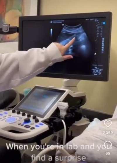 Girl found out she’s pregnant during a school lab 💀