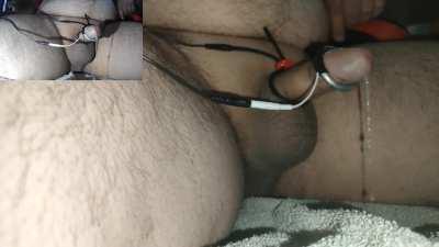 Dual cam cum eruption