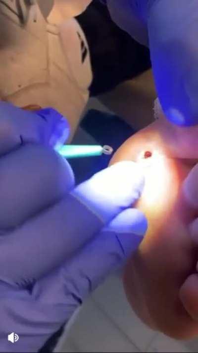 Thanks I hate feet popping