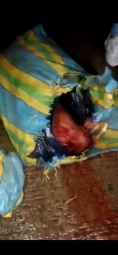 Decapitated head and other parts