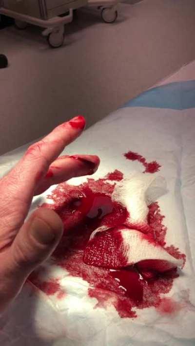 Almost cut my finger tip off today, enjoy.